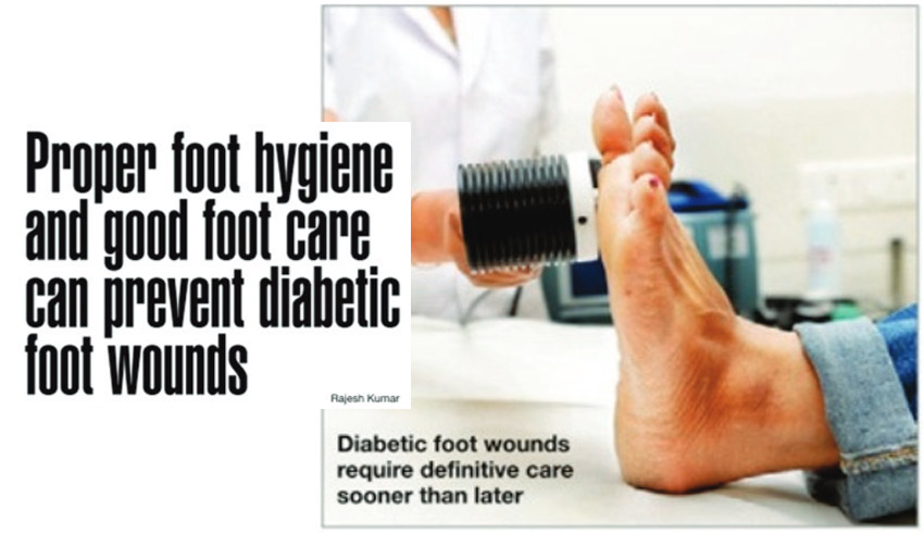 Proper foot hygiene and good food care can prevent diabetic foot wounds