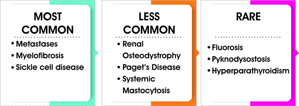 top-causes-of-increased-bone-density-chellaram-hospital